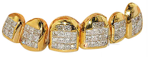 GoldGrills