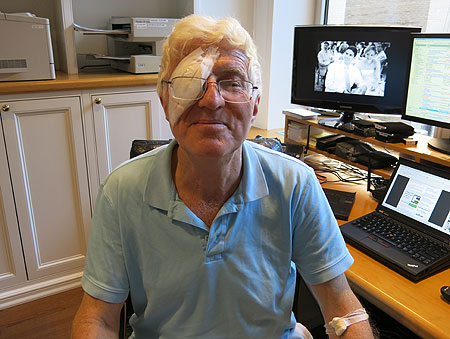 HarryAfterCataract