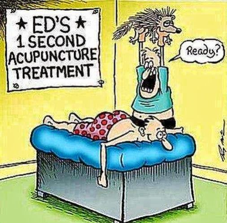 Accupuncture