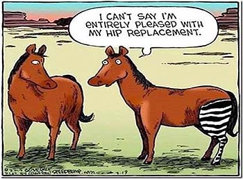 hipreplacement